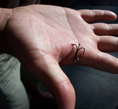 How to Remove a Fish Hook From Hand Like a Pro - Montana Hunting