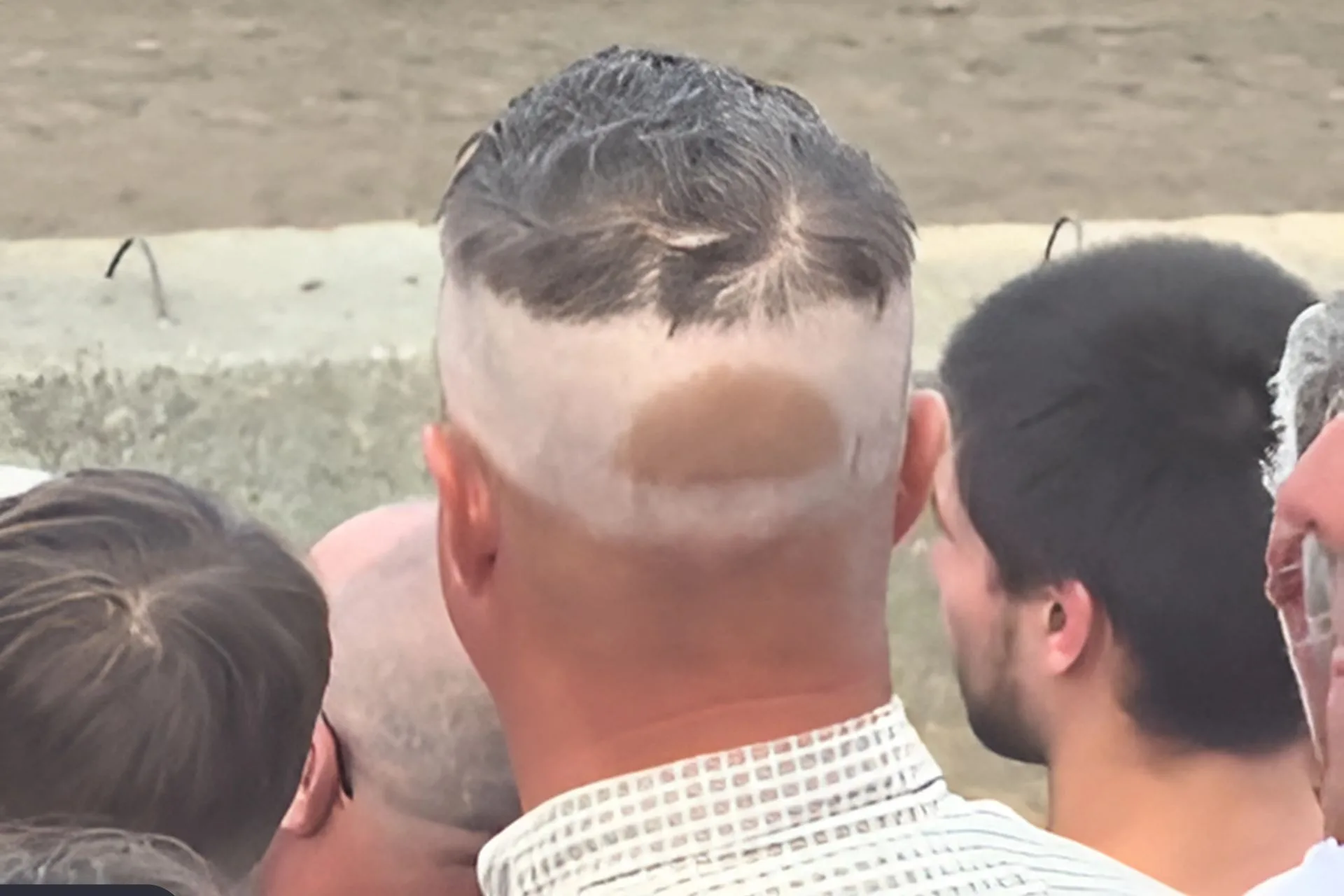 The Ultimate Badge of Outdoor Living: Tan Lines
